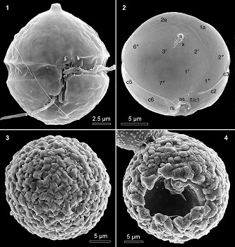 Lagoa em Ílhavo é morada de dinoflagelados desconhecidos até agora pela Ciência Biólogos da Universidade de Aveiro descobrem nova espécie de microalga