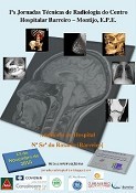 Centro Hospitalar Barreiro Montijo 1ªs Jornadas Técnicas de Radiologia subordinadas ao tema «Uma nova perspectiva sobre a Imagem»